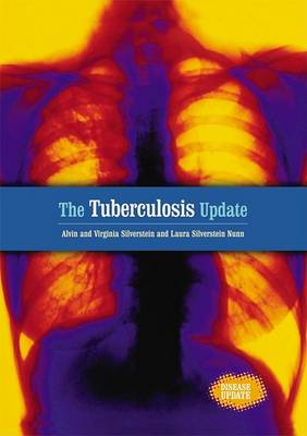 Book cover for The Tuberculosis Update