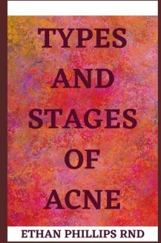 Cover of Types and Stages of Acne