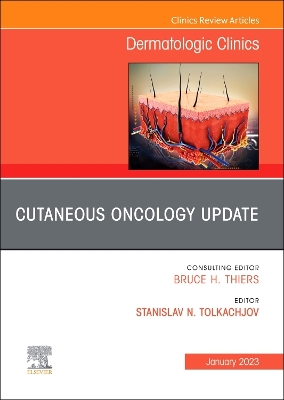 Cover of Cutaneous Oncology Update, an Issue of Dermatologic Clinics, E-Book