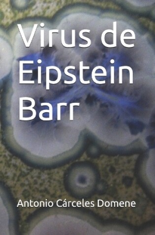 Cover of Virus de Eipstein Barr