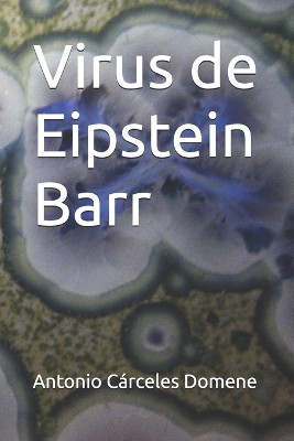 Cover of Virus de Eipstein Barr