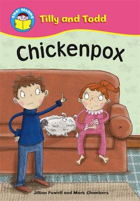 Book cover for Chickenpox