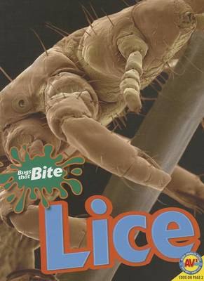 Cover of Lice