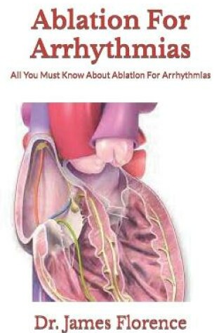 Cover of Ablation For Arrhythmias