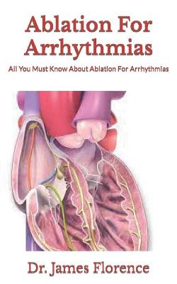 Book cover for Ablation For Arrhythmias