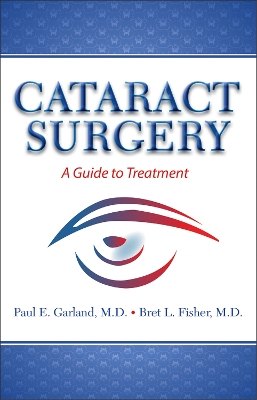 Book cover for Cataract Surgery