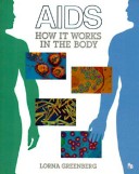 Cover of AIDS