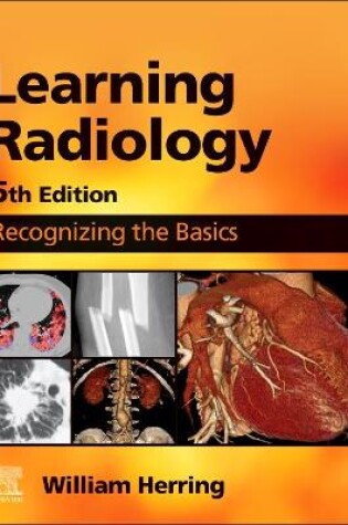 Cover of Learning Radiology E-Book