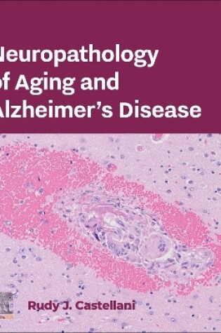 Cover of Neuropathology of Aging and Alzheimer’s Disease