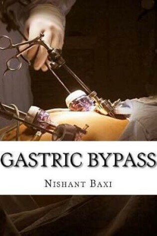 Cover of Gastric Bypass