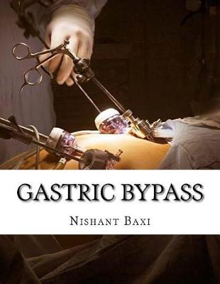 Book cover for Gastric Bypass