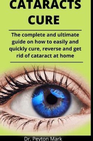 Cover of Cataracts Cure