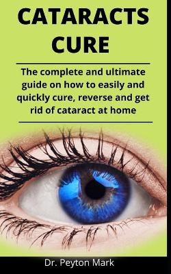 Book cover for Cataracts Cure