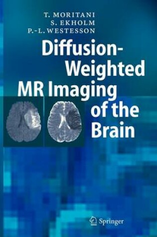 Cover of Diffusion-Weighted MR Imaging of the Brain