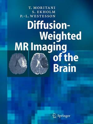 Book cover for Diffusion-Weighted MR Imaging of the Brain