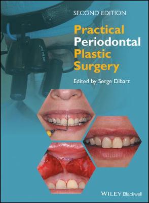 Book cover for Practical Periodontal Plastic Surgery