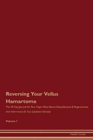 Cover of Reversing Your Vellus Hamartoma