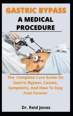 Book cover for Gastric Bypass A Medical Procedure