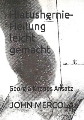 Book cover for Hiatushernie-Heilung leicht gemacht