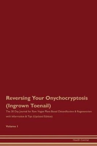 Cover of Reversing Your Onychocryptosis (Ingrown Toenail)