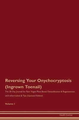 Book cover for Reversing Your Onychocryptosis (Ingrown Toenail)