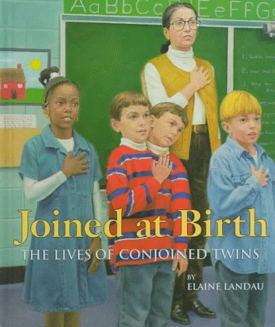 Book cover for Joined at Birth