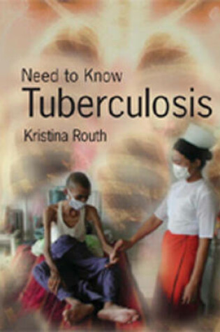 Cover of Need To Know: Tuberculosis Paperback