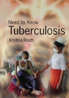 Book cover for Need To Know: Tuberculosis Paperback