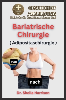 Book cover for Bariatrische Chirurgie ( Adipositaschirurgie)