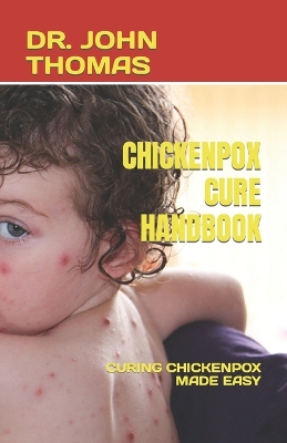 Book cover for Chickenpox Cure Handbook