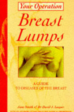 Cover of Breast Lumps