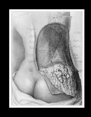Book cover for Posterior View of Lumbar Region