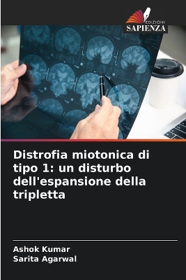 Book cover for Distrofia miotonica di tipo 1