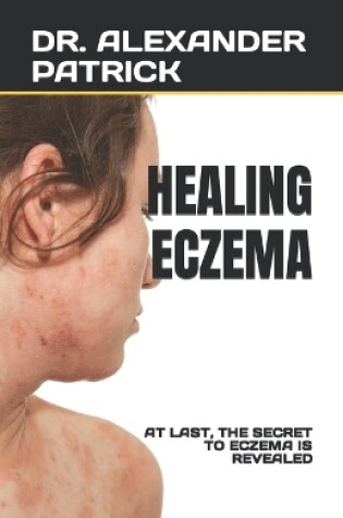 Cover of Healing Eczema