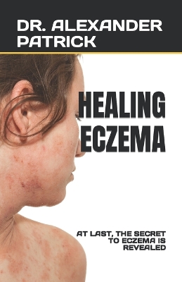 Book cover for Healing Eczema