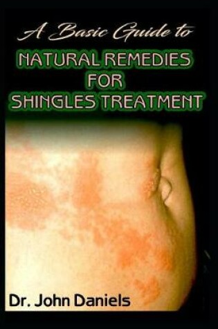 Cover of A Basic Guide To Natural Remedies for Shingles Treatment