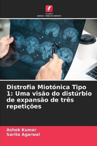 Cover of Distrofia Miotónica Tipo 1