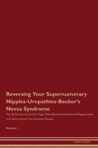 Cover of Reversing Your Supernumerary Nipples-Uropathies-Becker's Nevus Syndrome