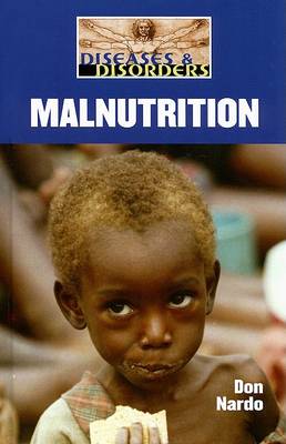 Book cover for Malnutrition