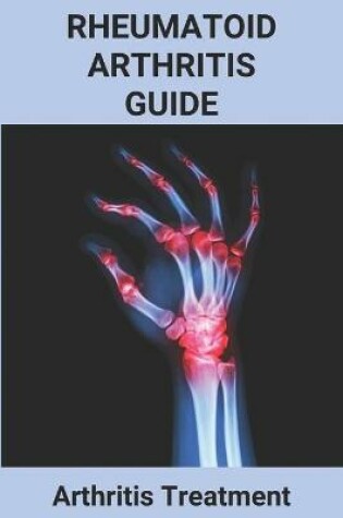 Cover of Rheumatoid Arthritis Guide