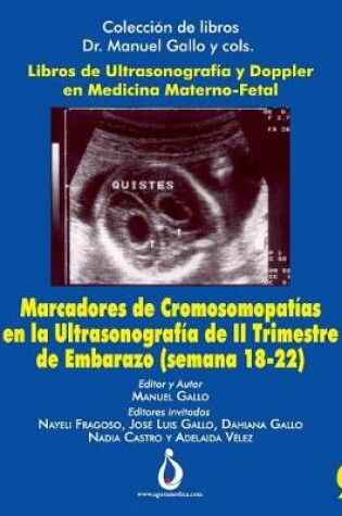Cover of Marcadores Cromosomopat as En La Ultrasonografia de II Trimestre de Embarazo (Semana 18-22)