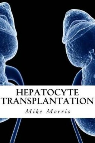 Cover of Hepatocyte Transplantation