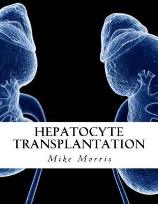 Book cover for Hepatocyte Transplantation