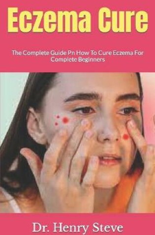 Cover of Eczema Cure