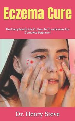 Book cover for Eczema Cure