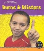 Book cover for Burns & Blisters