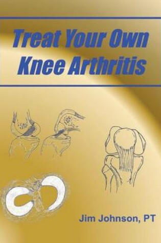 Cover of Treat Your Own Knee Arthritis