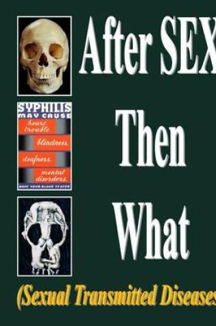 Cover of After Sex Then What