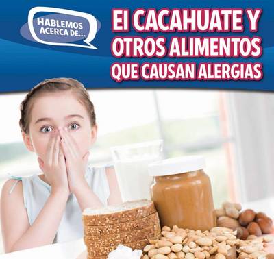 Cover of El Cacahuate Y Otros Alimentos Que Causan Alergias (Peanut and Other Food Allergies)