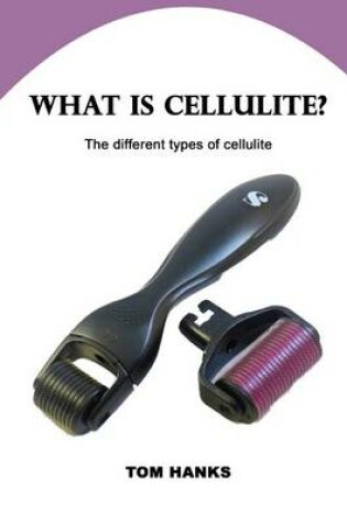 Cover of What Is Cellulite?